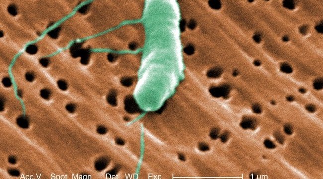 láb baktériumok enterobiosis tünetei gyermekeknél